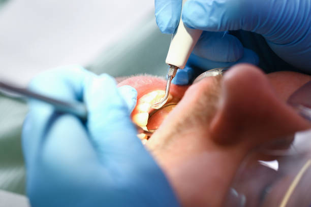 Best Mobile Emergency Dentist in Captains Cove, VA