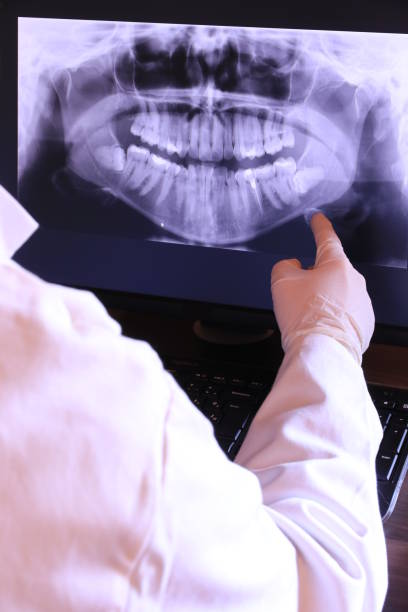 Best Emergency Root Canal Treatment in Captains Cove, VA