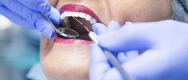 Best Emergency Root Canal Treatment in Captains Cove, VA